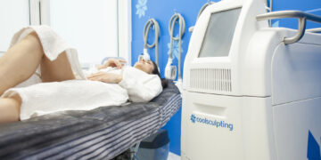 CoolSculpting im Trend - alles über die dauerhafte Fettreduktion